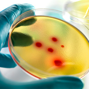Quality in Stem Cell Products